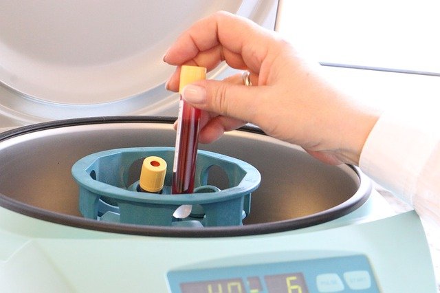 Analyse sanguine pratiquée à la clinique
